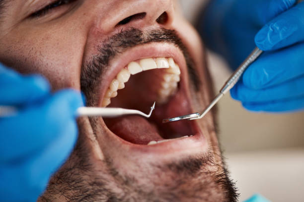 Sedation Dentistry in Bodfish, CA